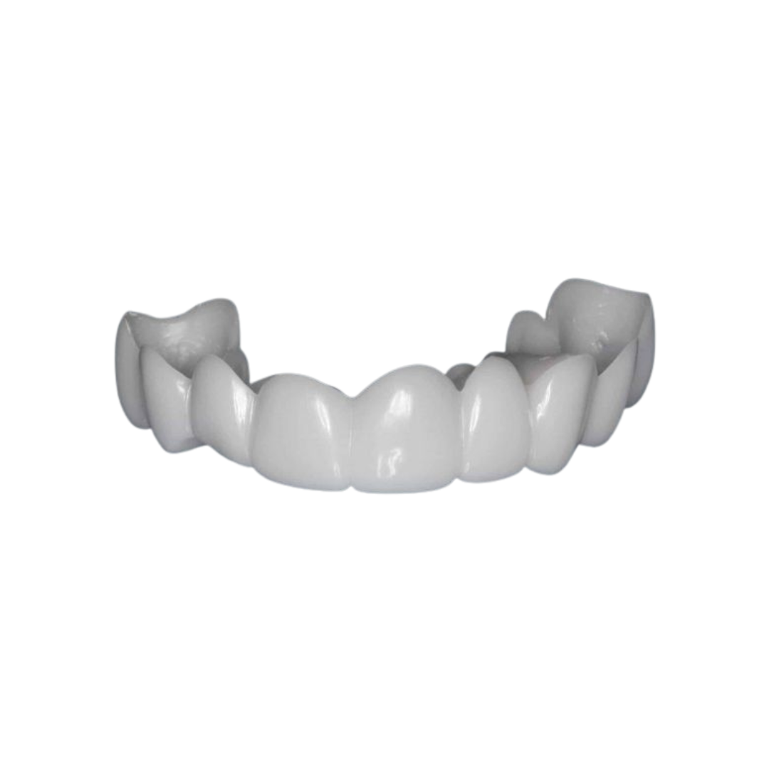 Finestis™ Snap-On Veneers