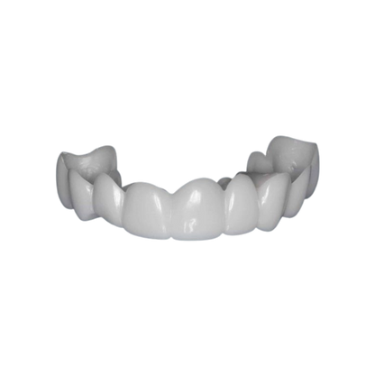 Finestis™ Snap-On Veneers