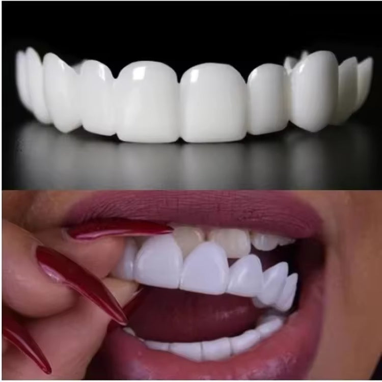 Finestis™ Snap-On Veneers