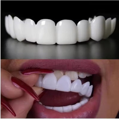 Finestis™ Snap-On Veneers