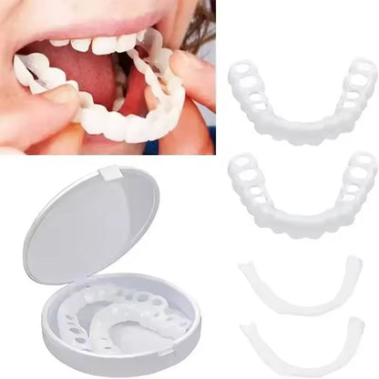Finestis™ Snap-On Veneers