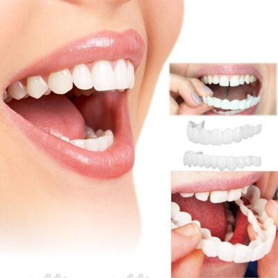 Finestis™ Snap-On Veneers
